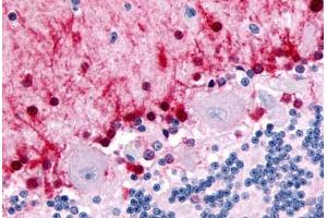 Immunohistochemistry (IHC) image for anti-Nuclear Receptor Subfamily 1, Group D, Member 2 (NR1D2) (Ligand Binding Domain) antibody (ABIN1049132)