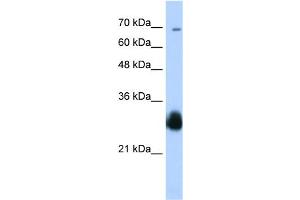 WB Suggested Anti-RNF138 Antibody Titration:  0. (RNF138 Antikörper  (C-Term))