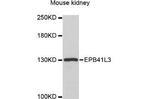 Western blot analysis of extracts of mouse kidney, using EPB41L3 antibody (ABIN6290317) at 1:3000 dilution. (EPB41L3 Antikörper)