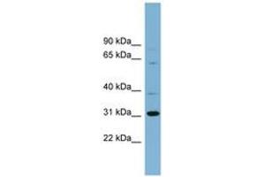 Image no. 1 for anti-Chromosome 22 Open Reading Frame 31 (C22orf31) (AA 71-120) antibody (ABIN6742136) (C22orf31 Antikörper  (AA 71-120))