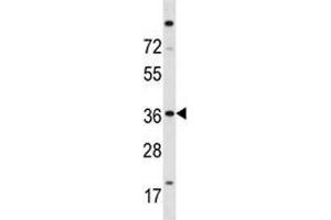 ISL2 antibody western blot analysis in A2058 lysate (ISL2 Antikörper  (AA 1-30))