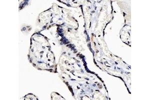 Immunohistochemistry analysis of paraffin-embedded human placenta using,GINS2 (ABIN7074041) at dilution of 1: 3000 (GINS2 Antikörper)
