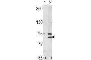 Western blot analysis of BRD2 (arrow) using rabbit polyclonal BRD2 Antibody (Center) (ABIN392609 and ABIN2842131). (BRD2 Antikörper  (AA 170-200))