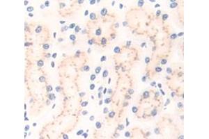 Used in DAB staining on fromalin fixed paraffin- embedded Kidney tissue (CD101 Antikörper  (AA 666-937))