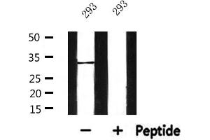 Western blot analysis of extracts from 293, using SLC25A6 Antibody. (SLC25A6 Antikörper  (Internal Region))