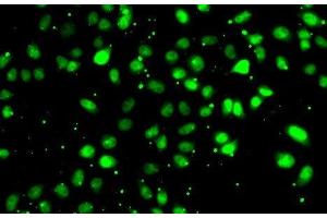 Immunofluorescence analysis of HeLa cells using NUDT2 Polyclonal Antibody (NUDT2 Antikörper)