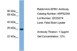 WB Suggested Anti-SPIN1  Antibody Titration: 0. (Spindlin 1 Antikörper  (Middle Region))