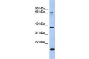 Image no. 1 for anti-Annexin A10 (ANXA10) (AA 179-228) antibody (ABIN6742711) (Annexin a10 Antikörper  (AA 179-228))