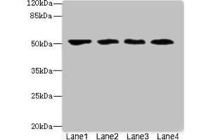 Western blot All lanes: LRRC42 antibody at 10 μg/mL Lane 1: MCF-7 whole cell lysate Lane 2: A549 whole cell lysate Lane 3: HCT116 whole cell lysate Lane 4: Colo320 whole cell lysate Secondary Goat polyclonal to rabbit IgG at 1/10000 dilution Predicted band size: 49 kDa Observed band size: 49 kDa (LRRC42 Antikörper  (AA 201-428))