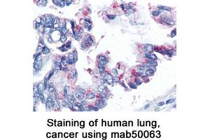 Image no. 1 for anti-Baculoviral IAP Repeat-Containing 5 (BIRC5) antibody (ABIN363217) (Survivin Antikörper)