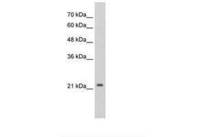 Image no. 3 for anti-Distal-Less Homeobox Protein 2 (DLX2) (AA 238-287) antibody (ABIN203372) (DLX2 Antikörper  (AA 238-287))
