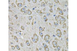 Immunohistochemistry of paraffin-embedded Mouse brain using PDIA6 Polyclonal Antibody at dilution of 1:100 (40x lens). (PDIA6 Antikörper)
