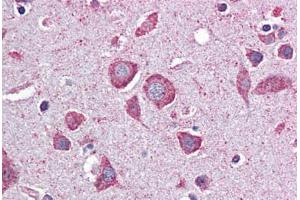 Immunohistochemistry (Formalin-fixed Paraffin-embedded Sections) (IHC (fp)) image for anti-Eukaryotic Translation Initiation Factor 2B, Subunit 2 Beta, 39kDa (EIF2B2) (AA 1-352) antibody (ABIN790635)