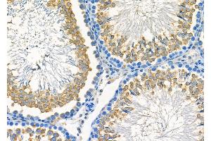 ABIN6261279 and ABIN6278060 at 1/100 staining Rat testis tissue by IHC-P. (DFFA Antikörper  (C-Term))