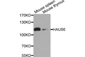 Western blot analysis of extract of mouse spleen and mouse thymus cells, using HAUS6 antibody. (FAM29A Antikörper)