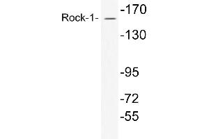 Western blot (WB) analysis of Rock-1 antibody in extracts from COS7 cells. (ROCK1 Antikörper)