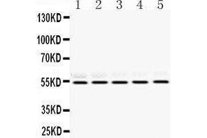 Western Blotting (WB) image for anti-Retinoblastoma Binding Protein 4 (RBBP4) (AA 395-425), (C-Term) antibody (ABIN3043920) (Retinoblastoma Binding Protein 4 Antikörper  (C-Term))