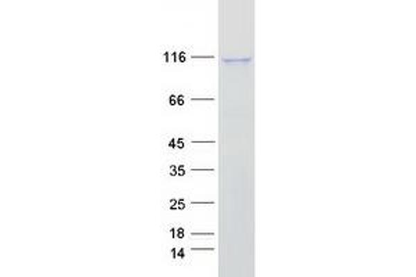 IDE Protein (Myc-DYKDDDDK Tag)