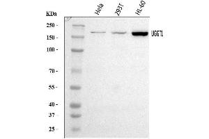Western blot analysis of UGGT/UGT1/UGGT1 using anti-UGGT/UGT1/UGGT1 antibody (ABIN7602690).