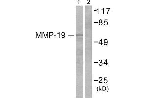 Western Blotting (WB) image for anti-Matrix Metallopeptidase 16 (Membrane-inserted) (MMP16) (C-Term) antibody (ABIN1848679) (MMP16 Antikörper  (C-Term))