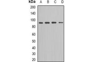 Western blot analysis of Kv11. (KCNH2 Antikörper)