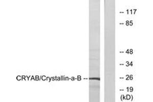 Western blot analysis of extracts from 293 cells, using CRYAB (Ab-19) Antibody.