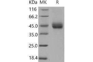 Western Blotting (WB) image for Tissue Factor Pathway Inhibitor (Lipoprotein-Associated Coagulation Inhibitor) (TFPI) (Active) protein (His tag) (ABIN7198255) (TFPI Protein (His tag))