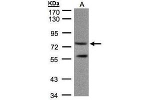 PDE4C Antikörper