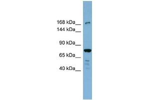WB Suggested Anti-DAPK1 Antibody Titration: 0. (DAP Kinase 1 Antikörper  (N-Term))