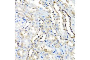Immunohistochemistry of paraffin-embedded rat kidney using HYAL1 antibody (ABIN5975045) at dilution of 1/100 (40x lens). (HYAL1 Antikörper)