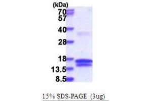 SDS-PAGE (SDS) image for Uridine-Cytidine Kinase 1 (UCK1) (AA 143-273) protein (His tag) (ABIN5853718) (UCK1 Protein (AA 143-273) (His tag))
