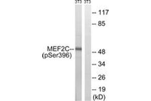 Western blot analysis of extracts from NIH-3T3 cells treated with starved 24h, using MEF2C (Phospho-Ser396) Antibody. (MEF2C Antikörper  (pSer396))