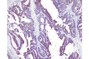 IHC analysis of SRI using anti-SRI antibody (ABIN6719388). (SRI Antikörper)