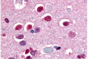Anti-NR4A3 antibody  ABIN1049142 IHC staining of human brain, neurons and glia. (NR4A3 Antikörper  (C-Term))