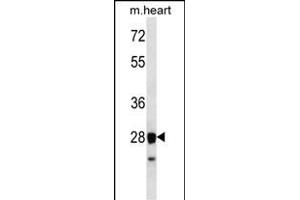 STX8 Antibody (N-term) (ABIN656580 and ABIN2845843) western blot analysis in mouse heart tissue lysates (35 μg/lane).