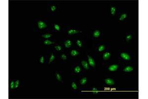 Immunofluorescence of purified MaxPab antibody to D21S2056E on HeLa cell. (RRP1 Antikörper  (AA 1-461))