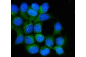 IF analysis of Hsp90 beta/HSP90AB1 using anti-Hsp90 beta/HSP90AB1 antibody (ABIN7602784).
