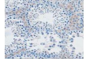 IHC-P analysis of Mouse Testis Tissue, with DAB staining. (NXN Antikörper  (AA 167-435))