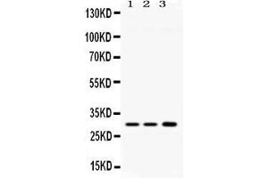 Western blot analysis of AQP11 expression in rat brain extract ( Lane 1), mouse brain extract ( Lane 2) and HELA whole cell lysates ( Lane 3). (AQP11 Antikörper  (N-Term))