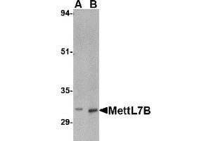 Western Blotting (WB) image for anti-Methyltransferase Like 7B (METTL7B) (C-Term) antibody (ABIN1030517) (METTL7B Antikörper  (C-Term))
