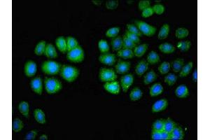 Immunofluorescent analysis of A549 cells using ABIN7163557 at dilution of 1:100 and Alexa Fluor 488-congugated AffiniPure Goat Anti-Rabbit IgG(H+L) (LCP1 Antikörper  (AA 2-627))