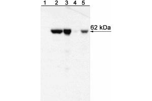 Western blot analysis of T-bet expressed by Mouse Th1 and Th2 cells and Human NK cell and T cell leukemia lines and Peripheral Blood Mononuclear Cells (PBMC). (T-Bet Antikörper)