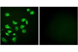 Immunofluorescence analysis of HepG2 cells, using GRP94 Antibody. (GRP94 Antikörper  (AA 754-803))