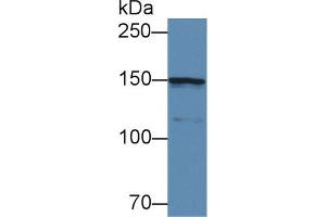 Western Blot; Sample: Mouse Cerebrum lysate; Primary Ab: 3µg/ml Rabbit Anti-Human COL4a5 Antibody Second Ab: 0. (COL4a5 Antikörper  (AA 1461-1685))