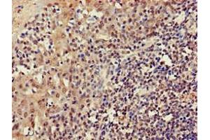 Immunohistochemistry of paraffin-embedded human tonsil tissue using ABIN7165618 at dilution of 1:100 (C22orf13 Antikörper  (AA 1-136))