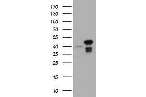 Image no. 1 for anti-Chromobox Homolog 8 (CBX8) (AA 1-260) antibody (ABIN1490666) (CBX8 Antikörper  (AA 1-260))