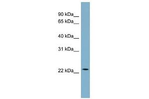 CCDC25 antibody used at 1 ug/ml to detect target protein. (CCDC25 Antikörper  (Middle Region))