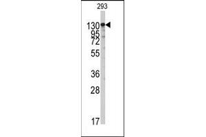 Image no. 2 for anti-Isoleucyl-tRNA Synthetase 2, Mitochondrial (IARS2) (Middle Region) antibody (ABIN360191) (IARS2 Antikörper  (Middle Region))