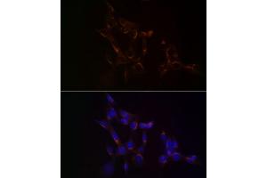 Immunofluorescence analysis of NIH/3T3 cells using USO1 Rabbit mAb (ABIN7271234) at dilution of 1:100 (40x lens). (USO1 Antikörper)