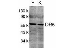 Western Blotting (WB) image for anti-Tumor Necrosis Factor Receptor Superfamily, Member 10b (TNFRSF10B) (C-Term) antibody (ABIN1030367) (TNFRSF10B Antikörper  (C-Term))